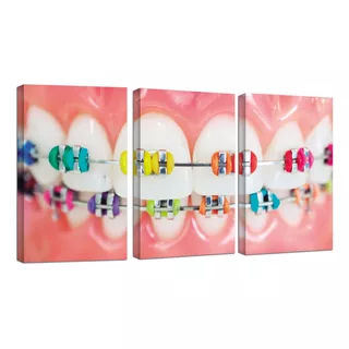 Tríptico Cuadros Canvas Dentista Brackets Dientes 100x180cm