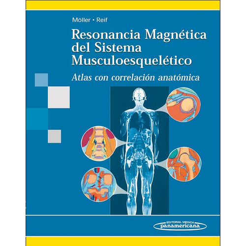 Resonancia Magnética Del Sistema Musculoesquelético