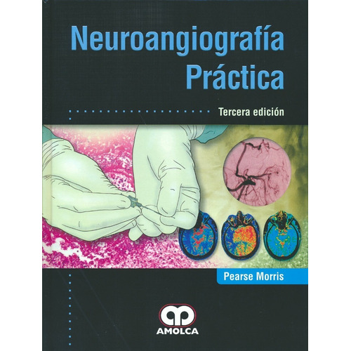 Libro Neuroangiografía Práctica.