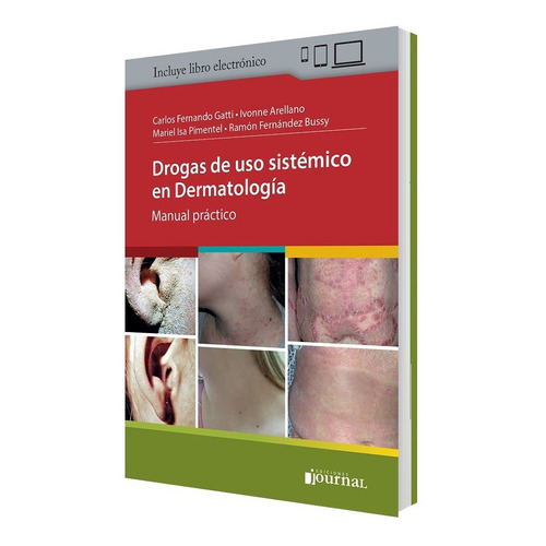 Gatti Drogas De Uso Sistémico En Dermatología T/ País