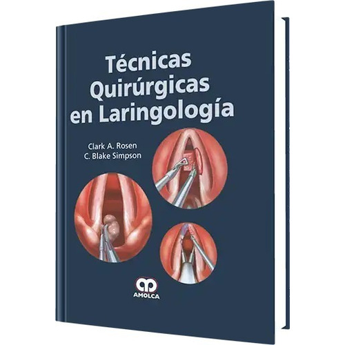 Técnicas Quirúrgicas En Laringología Rosen