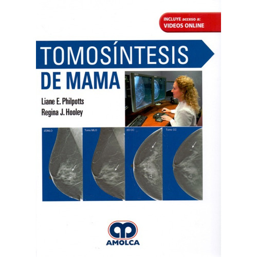 Philpotts Tomosíntesis De Mama 1era Ed. 2018!