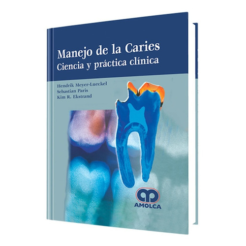 Manejo De La Caries. Ciencia Y Práctica Clínica. Amolca