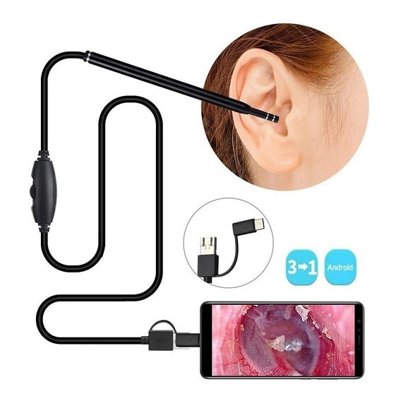 Cámara Otoscopio - Endoscopio Para Oido 3 En 1 Usb Tipo C