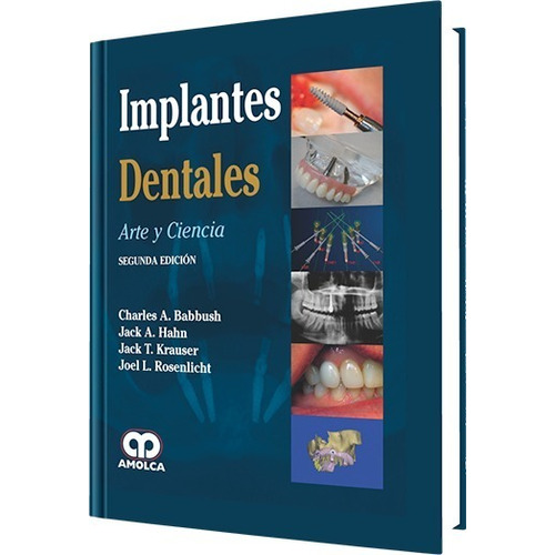 Implantes Dentales Arte Y Ciencia 2da Ed.