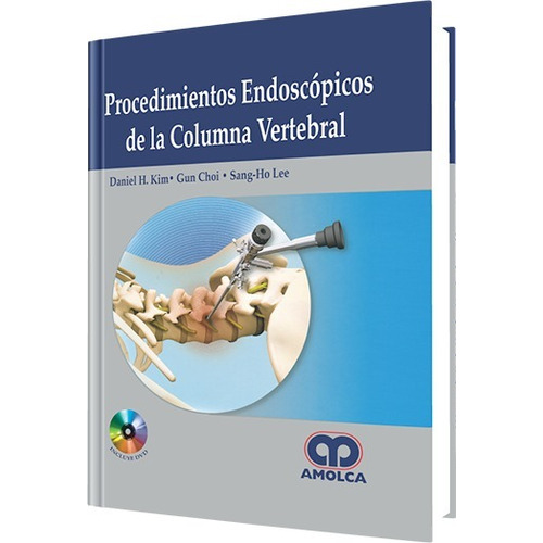 Procedimientos Endoscópicos De Columna Vertebral Kim Amolca