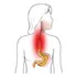Aceite De Copaiba -gastritis,ulceras,acidez,dermatitis- Perú