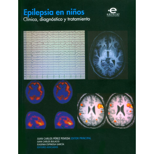 Epilepsia En Niños Clinica Diagnostico Y Tratamiento, De Pérez Poveda, Juan Carlos. Editorial Pontificia Universidad Javeriana, Tapa Blanda, Edición 1 En Español, 2014