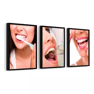 Kit 3 Quadros Odontológico Dentista Sorriso E Dentes 30x45cm