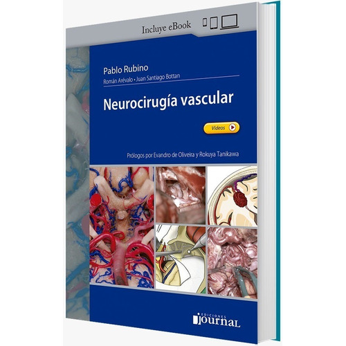 Rubino / Arévalo / Bottan Neurocirugía Vascular C/env