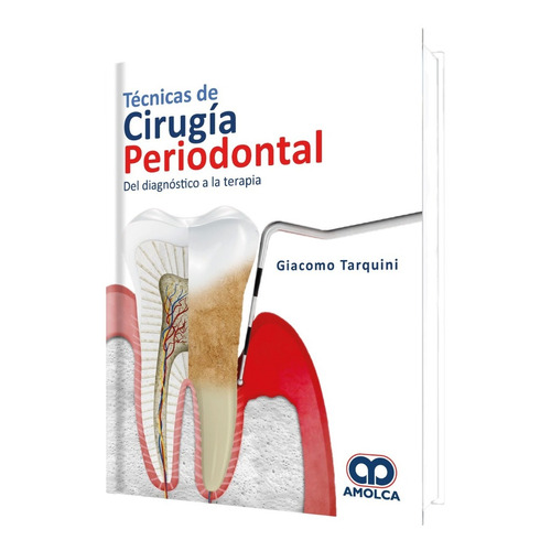 Técnicas De Cirugía Periodontal Diagnóstico Terapia Tarquini