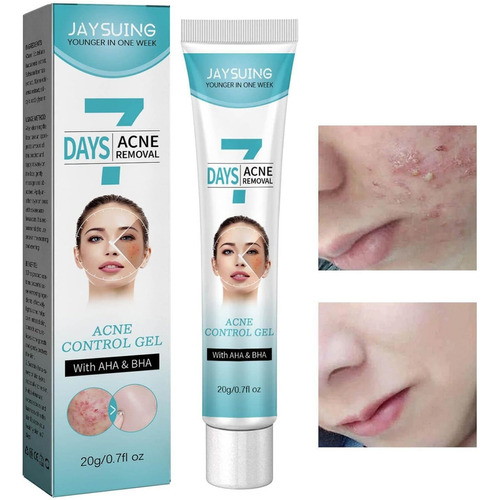 Crema Tratamiento Acne Facial Momento De Aplicación Noche Tipo De Piel Todo Tipo De Piel