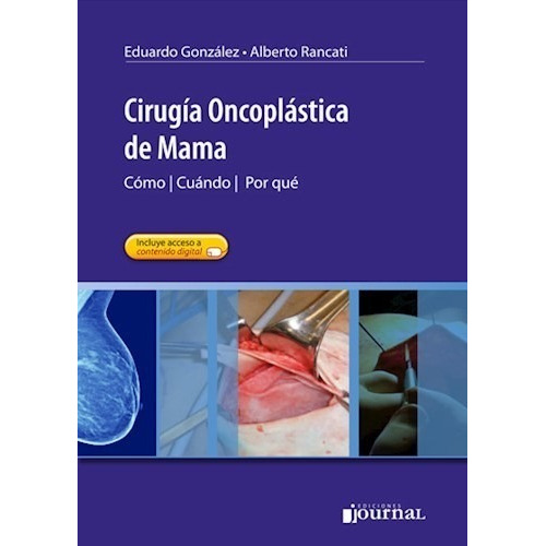 Libro - Cirugía Oncoplástica De Mama González !