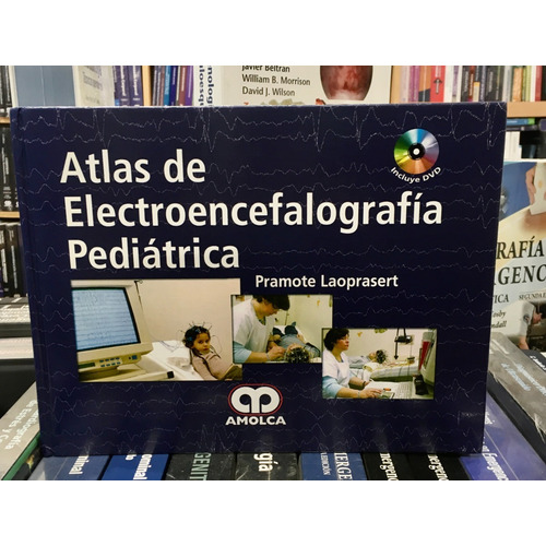 Atlas De Electroencefalografía Pediátrica