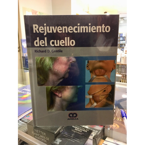 Rejuvenecimiento Del Cuello