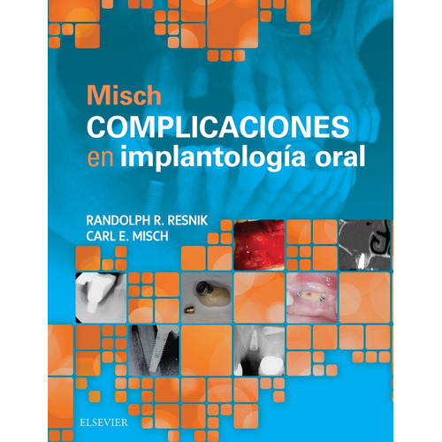 Misch Complicaciones En Implantología Oral ¡ !