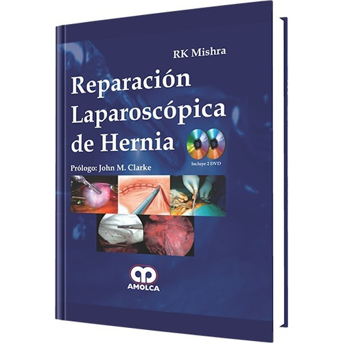 Reparación Laparoscópica De Hernia 2 Dvd