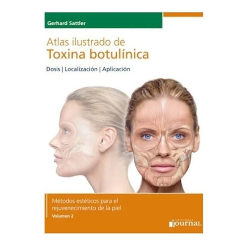 Atlas Ilustrado De Toxina Botulinica