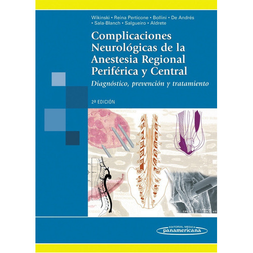 Complicaciones Neurológicas De La Anestesia Regional Perif, De Wikinski. Editorial Medica Panamericana, Tapa Blanda, Edición 2 En Español, 2011