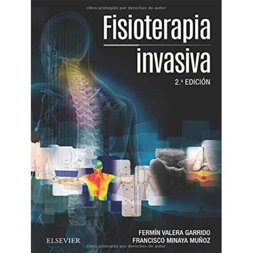 Fisioterapia Invasiva 2ed Valera