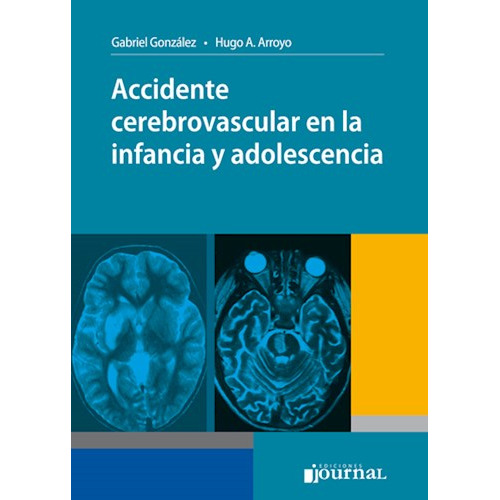 Accidente Cerebrovascular En Infancia Y Adolescencia Arroyo