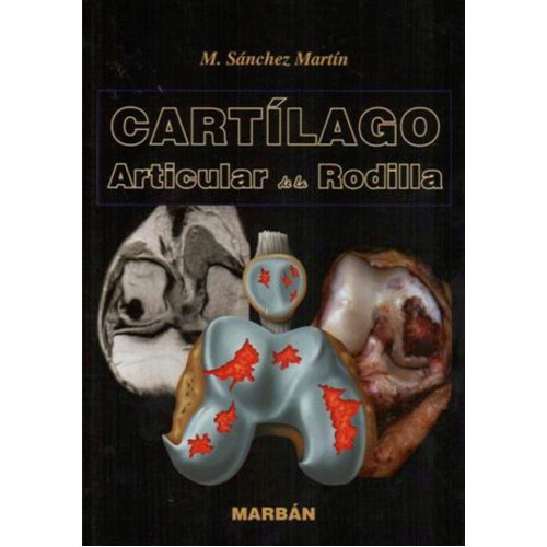 Cartílago Articular De La Rodilla Sánchez Martín, De M. Sánchez Martín., Vol. 1. Editorial Marban, Tapa Dura, Edición 1 En Español, 2011
