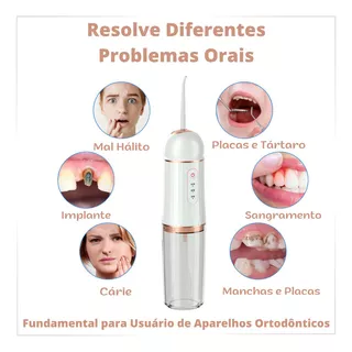 Irrigador Bucal Jato Fio Oral Limpa Aparelho Dental Slu Med 
