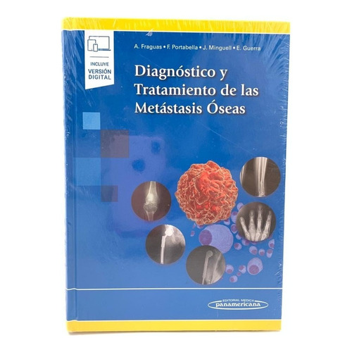 Diagnóstico Y Tratamiento De Las Metástasis Óseas Fraguas