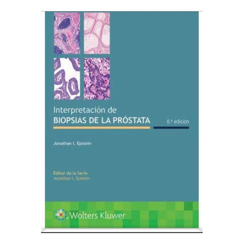 Epstein Interpretación De Biopsias De La Próstata. 6 Edición