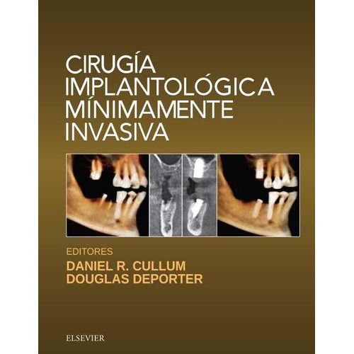 Cirugía Implantológica Mínimamente Invasiva, De Cullum. Editorial Elsevier, Tapa Dura En Español, 2018
