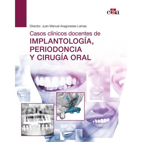 Casos Clinicos Docentes De Implantologia Periodoncia Y Cirugia Or, De Vvaa. Editorial Edra, Tapa Blanda En Español
