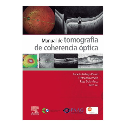 Gallego Manual De Tomografía De Coherencia Óptica 1era Ed.