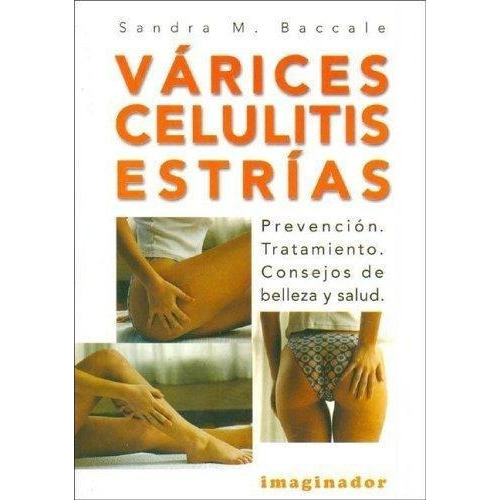 Varices, Celulitis Y Estrias, De Baccale, Sandra M.. Editorial Imaginador En Español