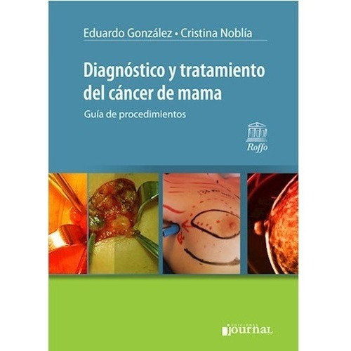 Diagnostico Y Tratamiento Del Cancer De Mama