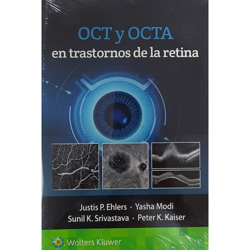 Oct Y Octa En Trastornos De La Retina, De Ehlers, J.., Vol. N/a. Editorial Wolters Kluwer, Tapa Blanda En Español, 2021