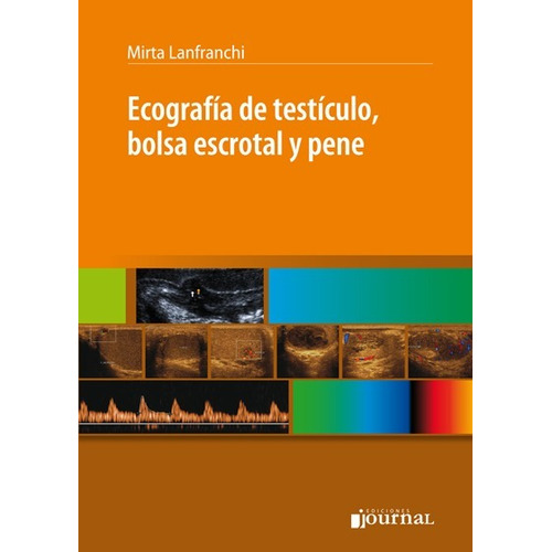 Ecografía De Testículo Bolsa Escrotal Y Pene Lanfranchi