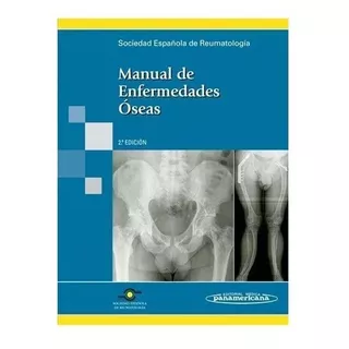 Manual De Enfermedades Óseas Ser, De Ser. Editorial Médica Panamericana En Español