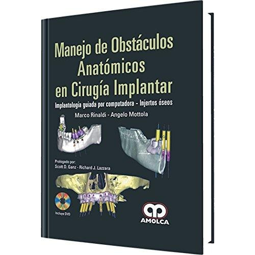 Manejo De Obstáculos  Anatómicos En Cirugía Implantar.