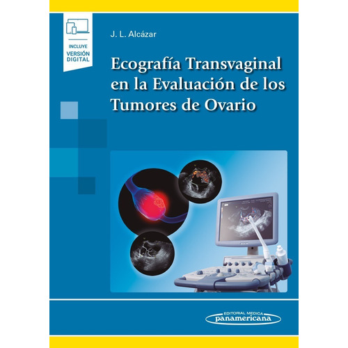 Ecografía Transvaginal En La Evaluación De Tumores De Ovario