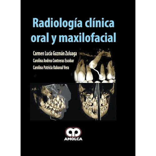 Radiología Clínica Oral Y Maxilofacial, De Guzmán Zuluaga, Carmen Lucia. Editorial Amolca En Español