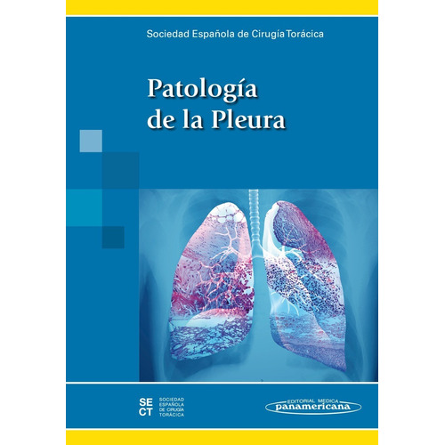 Patología De La Pleura Sect