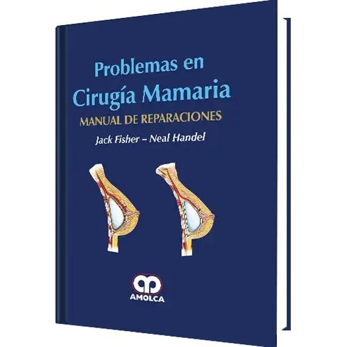 Problemas En Cirugía Mamaria Manual De Reparaciones.