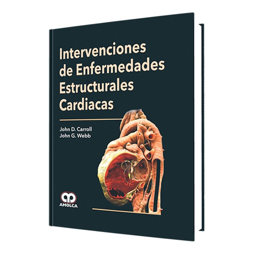 Intervenciones  Enfermedades Estructurales Cardiacas. Amolca