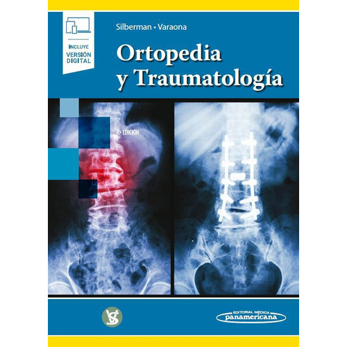 Ortopedia Y Traumatología : Libro + Ebook, De Silberman-varaona, Oscar. Editorial Editorial Medica Panamericana, Tapa Blanda, Edición 4 En Español, 2018