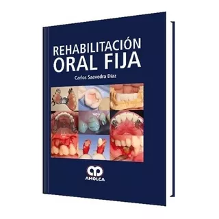 Rehabilitación Oral Fija.