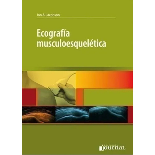 Ecografía Musculoesquelética - Jacobson, Jan