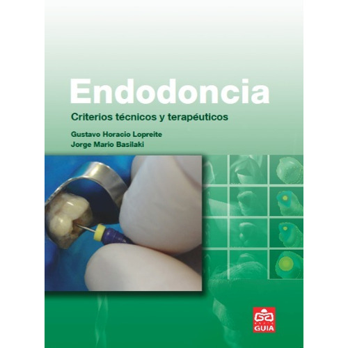 Endodoncia Criterios Tecnicos Y Terapeuticos