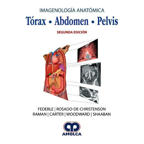 Imagenología Anatómica. Tórax, Abdomen, Pelvis, De Federle. Editorial Amolca En Español