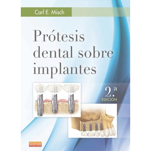 Prótesis Dental Sobre Implantes 2da Edición