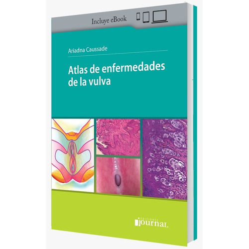 Atlas De Enfermedades De La Vulva Caussade  1ª Ed Año 2022